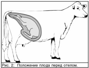 Рисунок положения плода