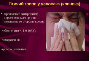 Симптомы птичьего гриппа у человека